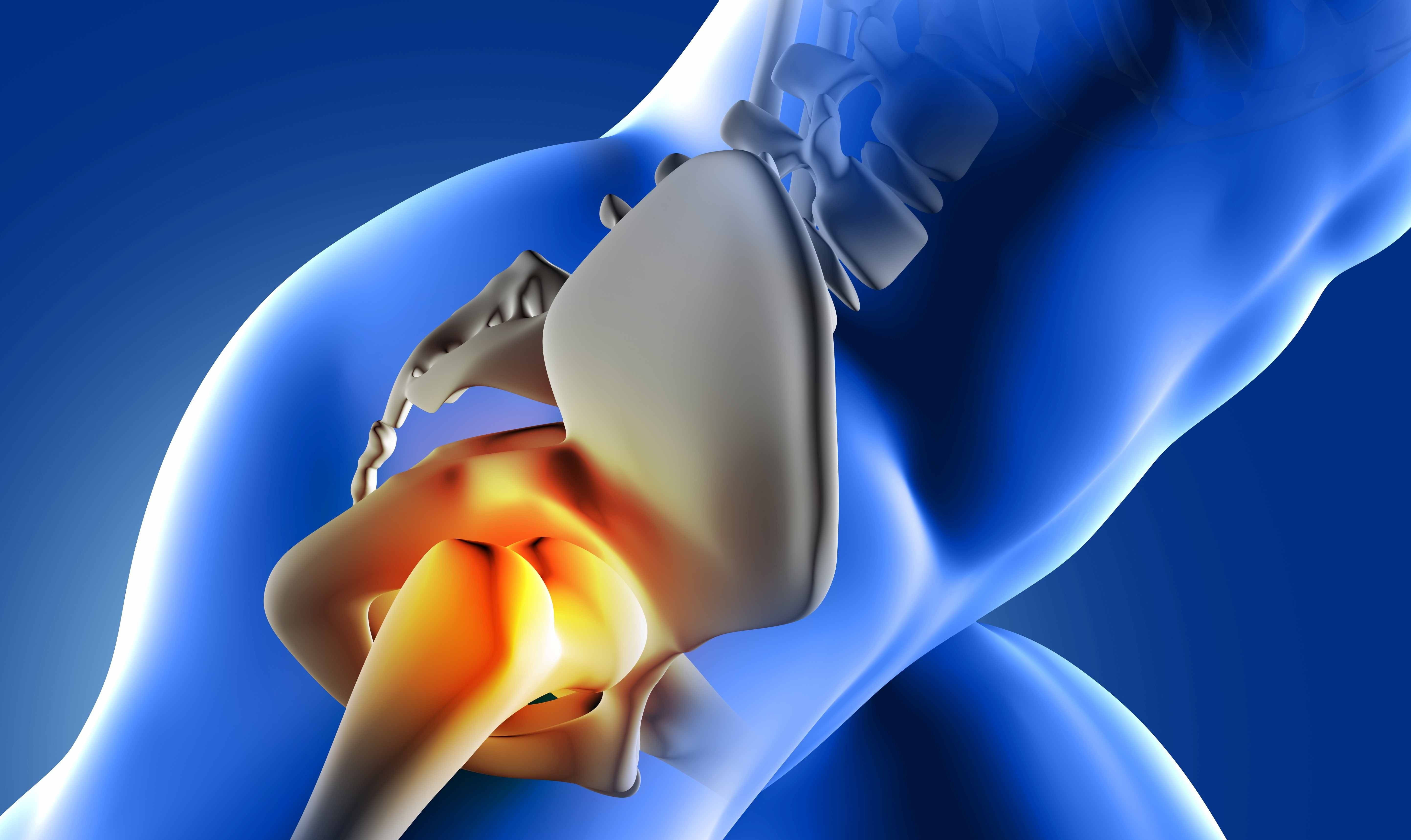 Hip joint pain transparent coloured view